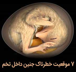 هفت موقعیت خطرناک جنین در تخم با خروج از دستگاه جوجه کشی