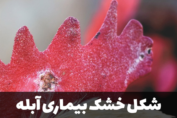 شکل خشک بیماری آبله