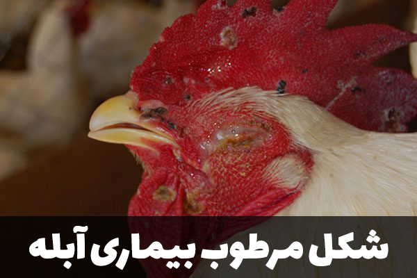 شکل مرطوب بیماری آبله