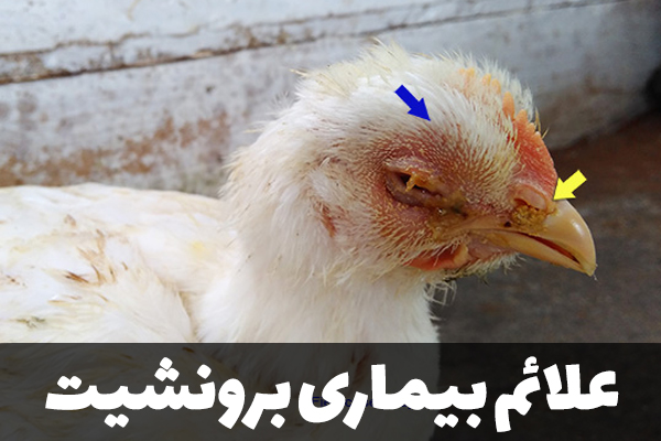 علائم بیماری برونشیت